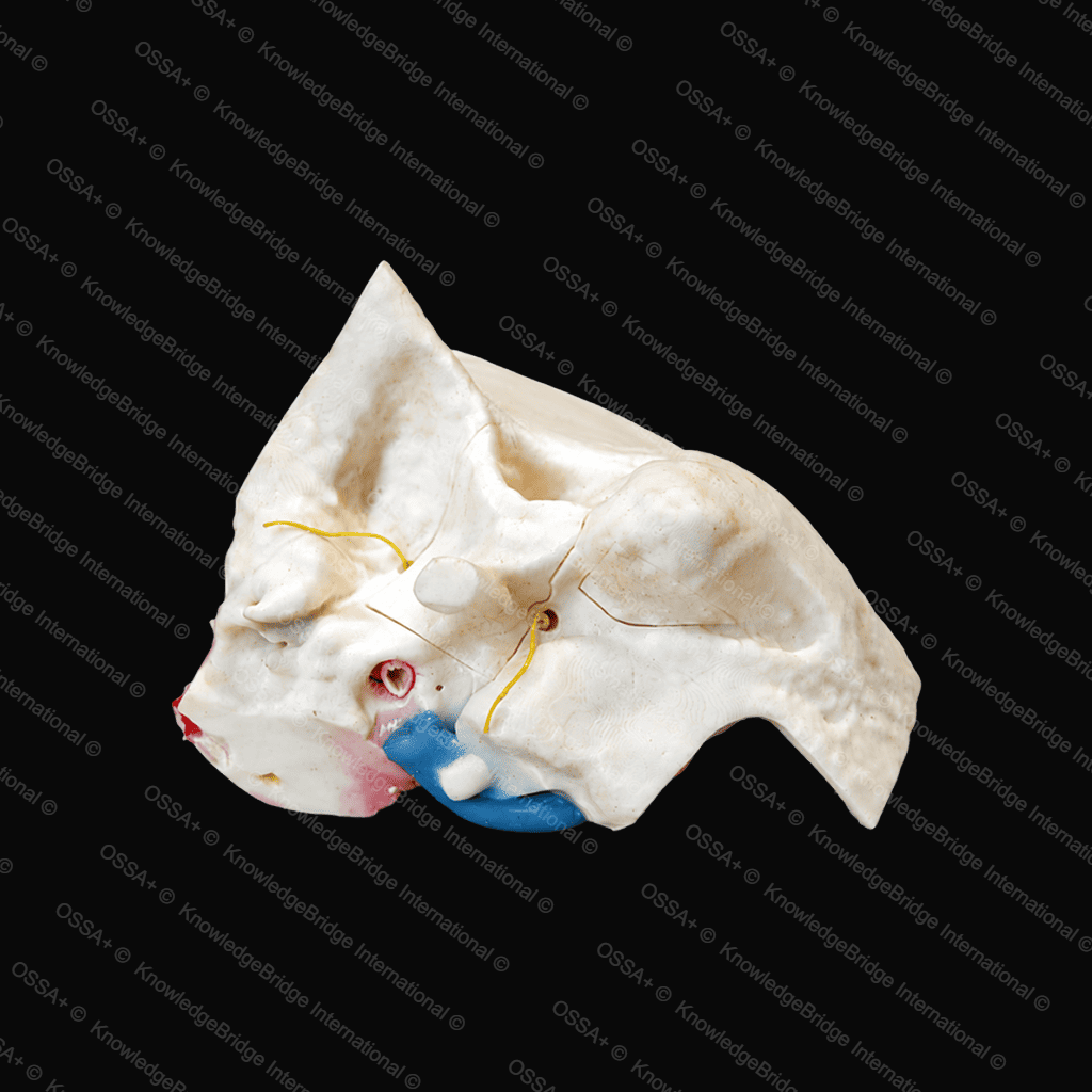 Cochlear Implant Model view 2