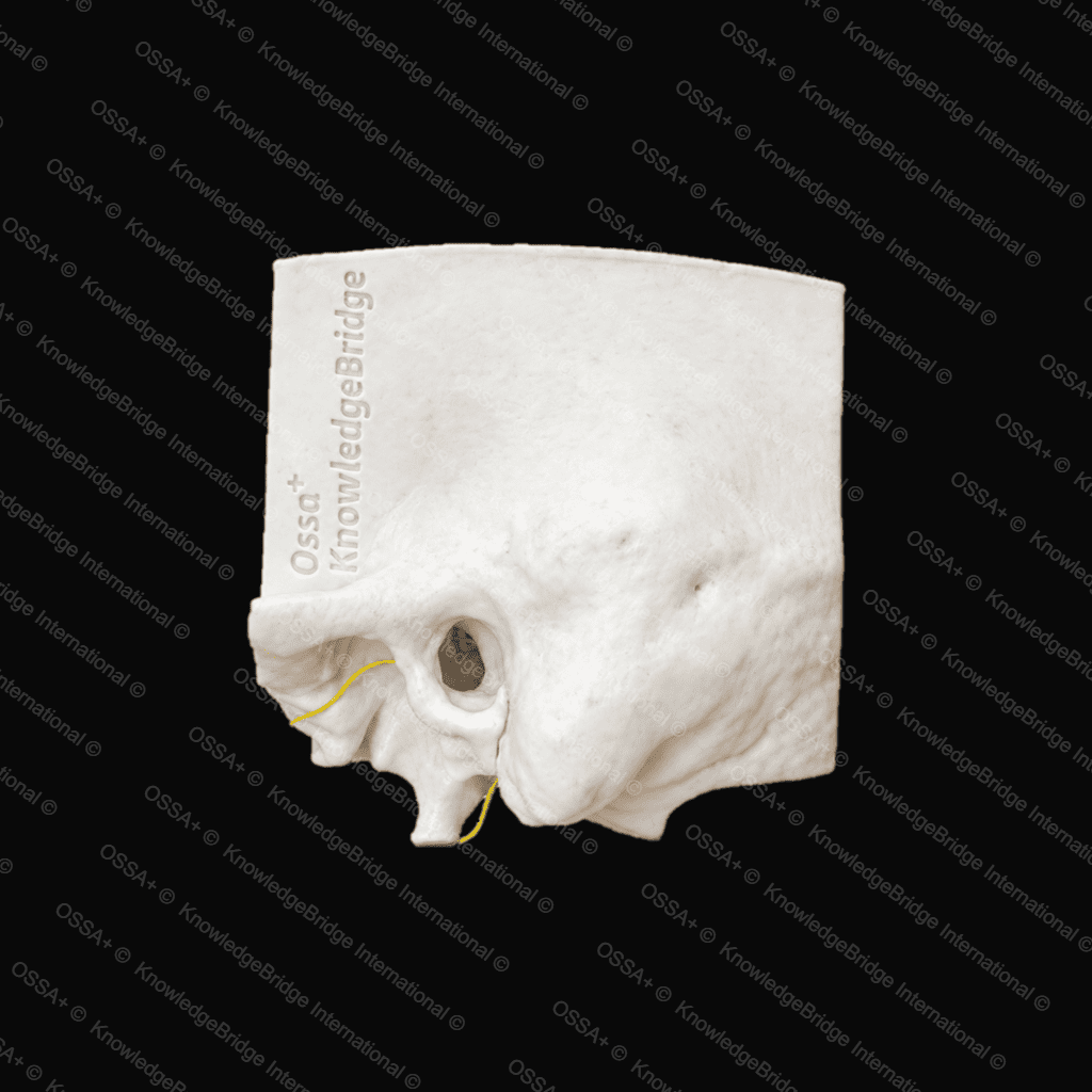Cochlear Implant Model view 1